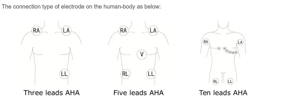 5-проводни ЕКГ-проводници за Philips digitrak плюс 24 часов холтер 3100А, 5-проводник, Snap